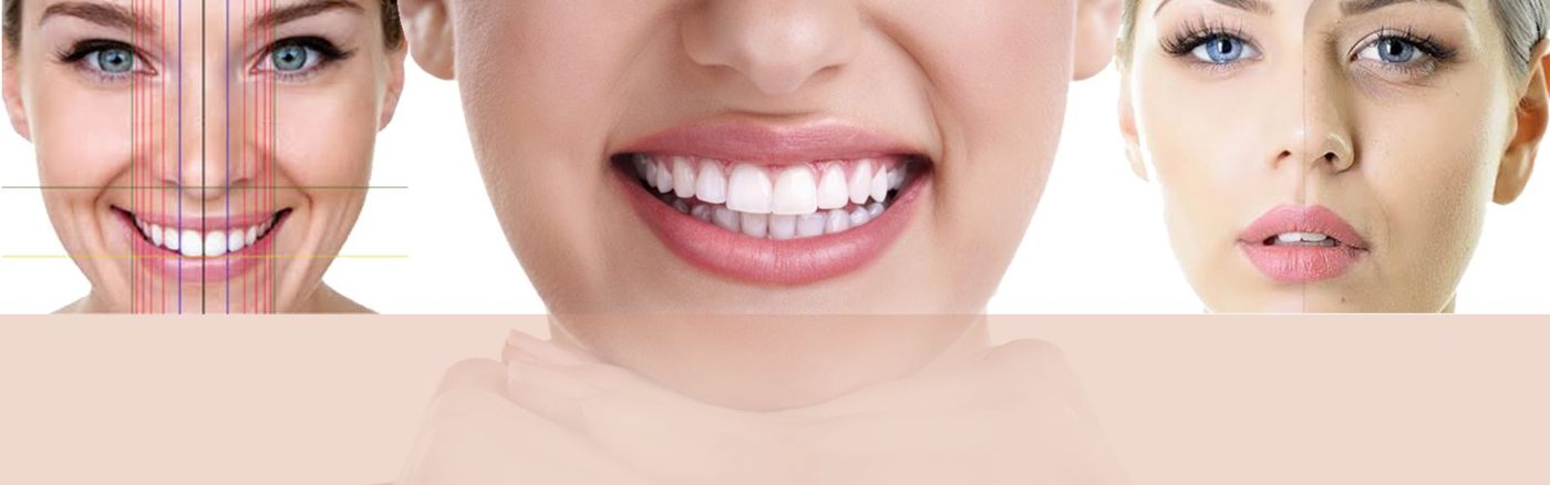 Digital Smile Design